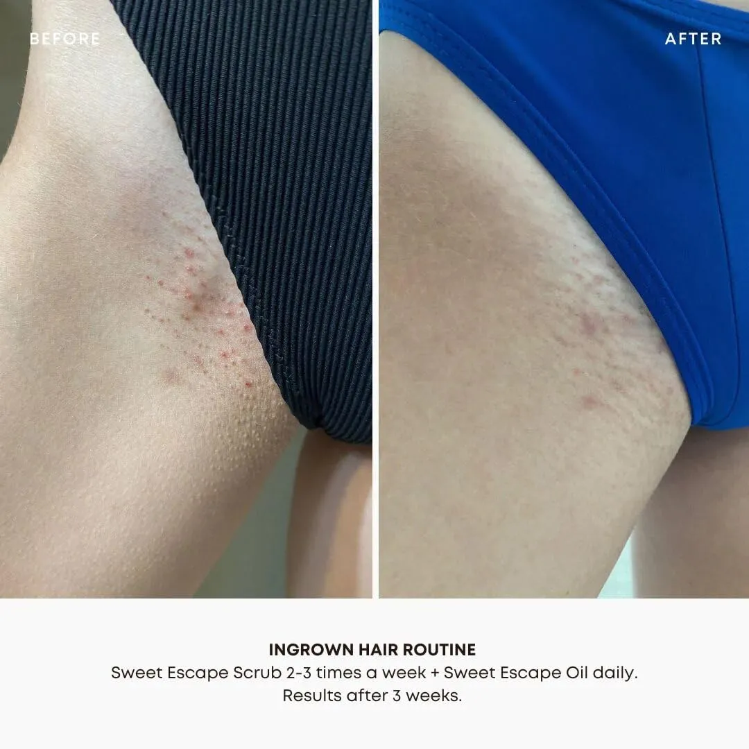 Bushbalm Ingrown Hair and Razor Bumps Minimizer 3-Step Routine - Includes Nude Ingrown Hair Oil (30 ml), Sweet Escape Exfoliating Scrub (236 ml) and Nordic Dry Brush