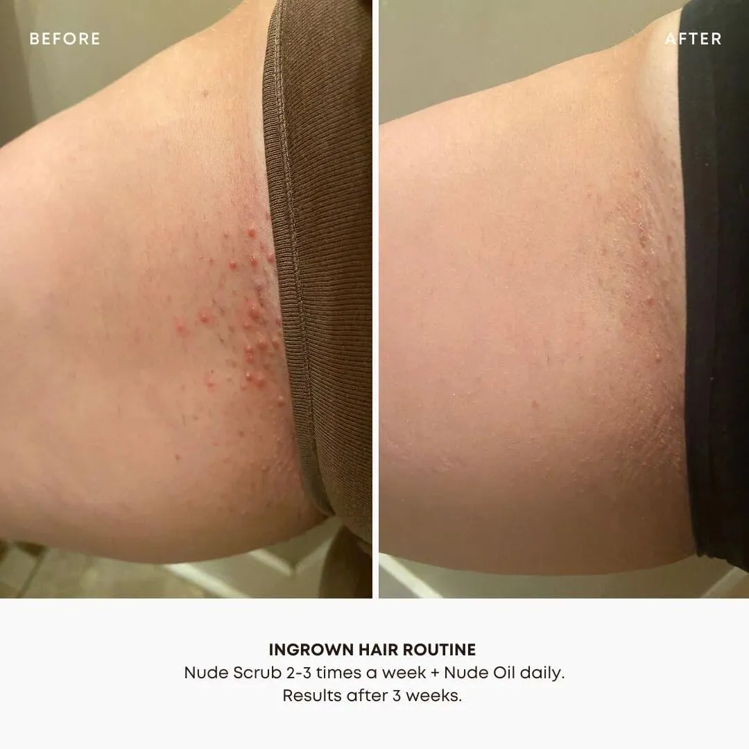 Bushbalm Ingrown Hair and Razor Bumps Minimizer 3-Step Routine - Includes Nude Ingrown Hair Oil (30 ml), Sweet Escape Exfoliating Scrub (236 ml) and Nordic Dry Brush