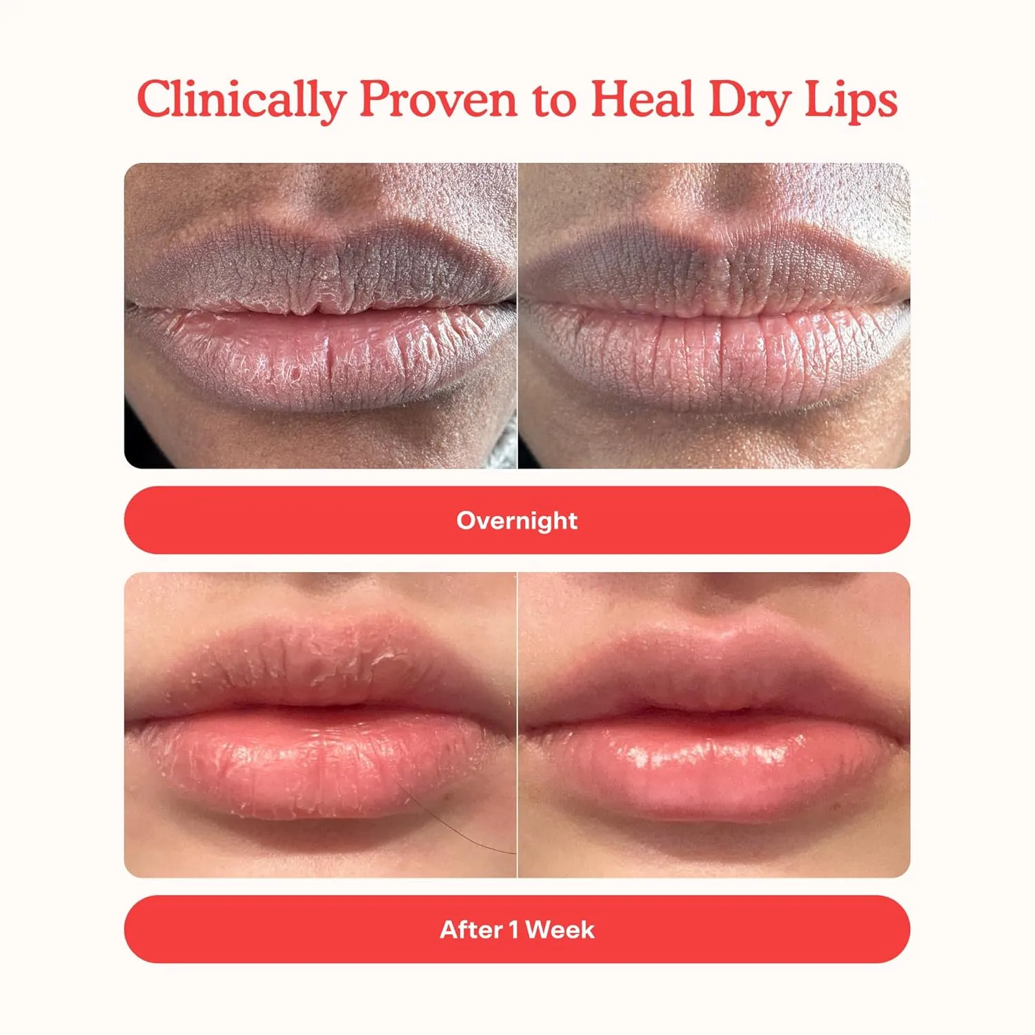 Tower 28 LipSoftie Hydrating Lip Treatment Balm, Moisturizing Lip Mask for Chapped Lips - SOS Vanilla Flavor, Clear Gloss
